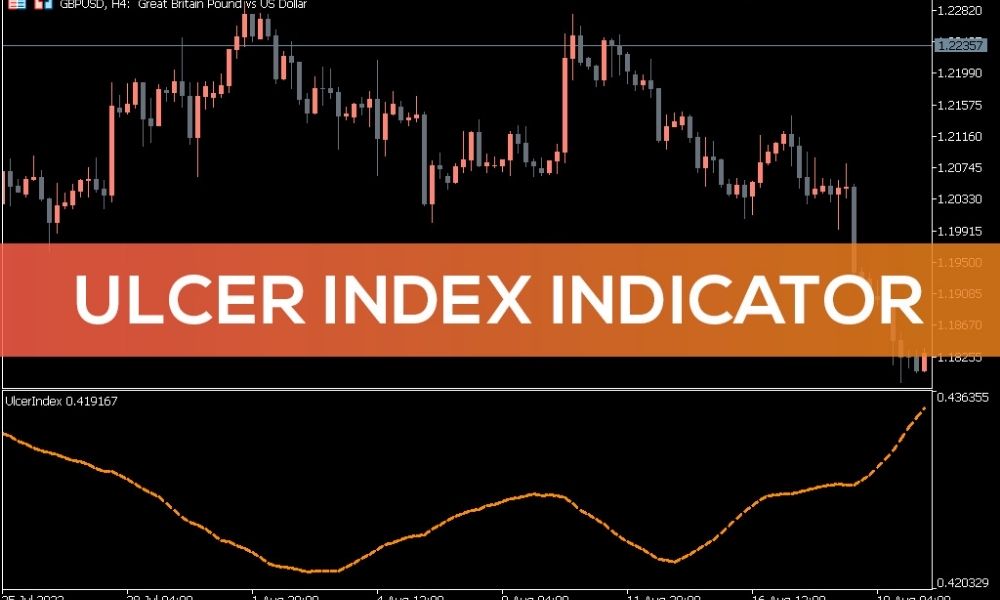 Ulcer Index là gì? Cách tính và ứng dụng đánh giá rủi ro 2 Khái niệm Ulcer Index